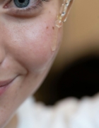 Dermatitis seborreica, guía completa para cuidar tu cuero cabelludo