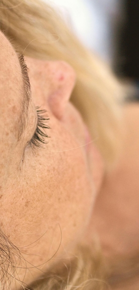Manchas faciales: causas, tipos y cómo tratarlas de forma eficaz