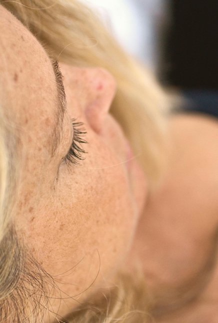 Manchas faciales: causas, tipos y cómo tratarlas de forma eficaz