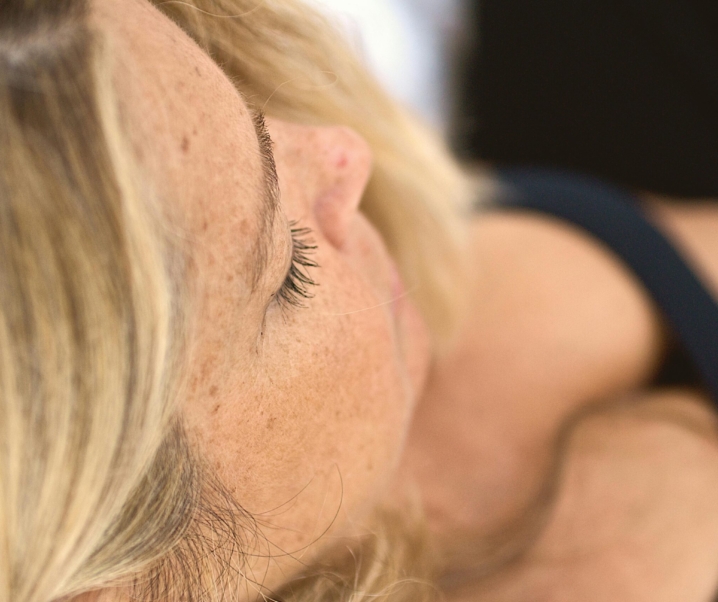 Manchas faciales: causas, tipos y cómo tratarlas de forma eficaz